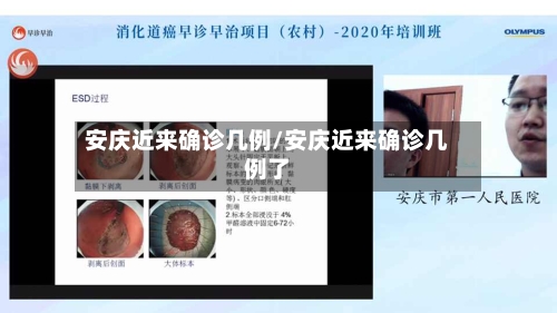 安庆近来确诊几例/安庆近来确诊几例了