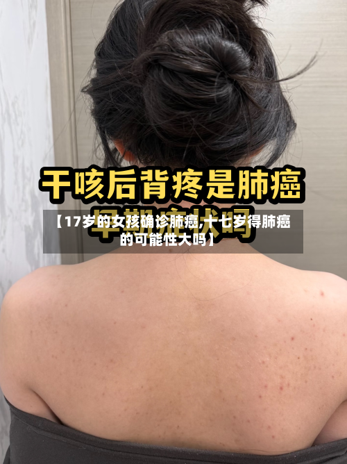 【17岁的女孩确诊肺癌,十七岁得肺癌的可能性大吗】