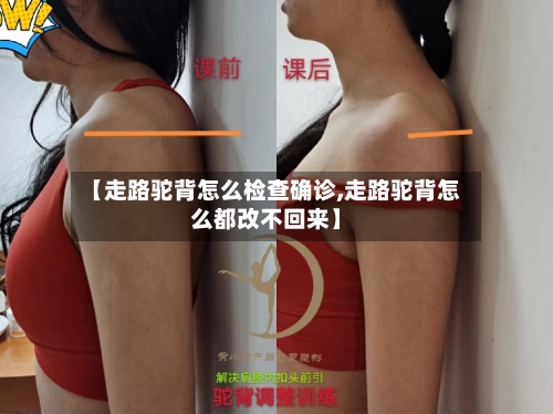 【走路驼背怎么检查确诊,走路驼背怎么都改不回来】