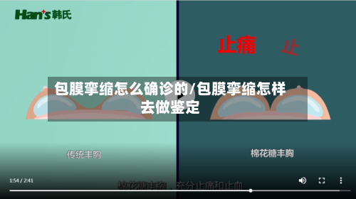 包膜挛缩怎么确诊的/包膜挛缩怎样去做鉴定