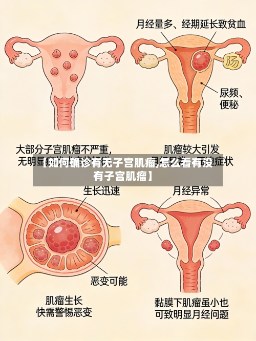 【如何确诊有无子宫肌瘤,怎么看有没有子宫肌瘤】