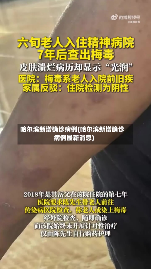 哈尔滨新增确诊病例(哈尔滨新增确诊病例最新消息)