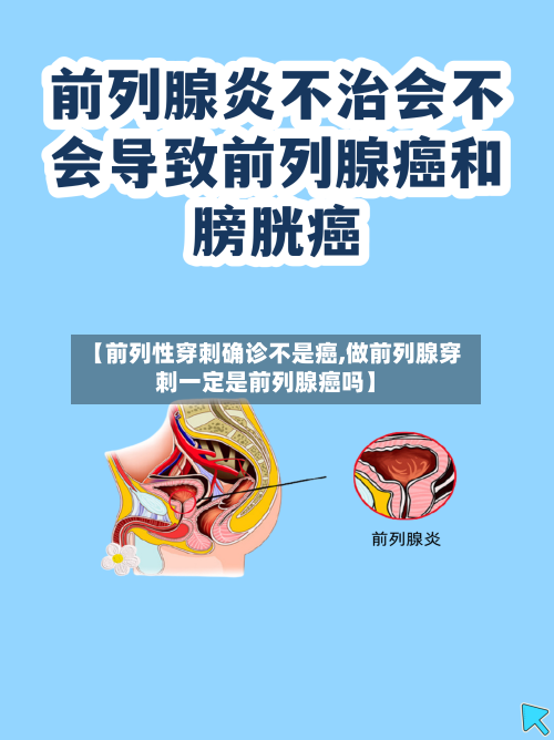 【前列性穿刺确诊不是癌,做前列腺穿刺一定是前列腺癌吗】
