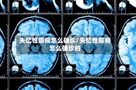 失忆性癫痫怎么确诊/失忆性癫痫怎么确诊的