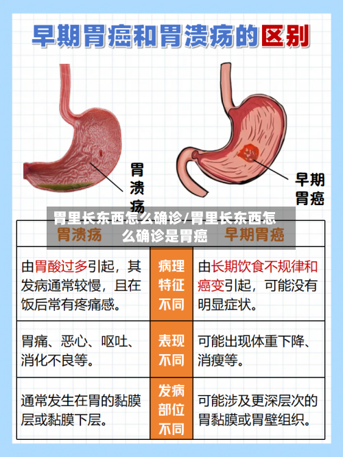 胃里长东西怎么确诊/胃里长东西怎么确诊是胃癌