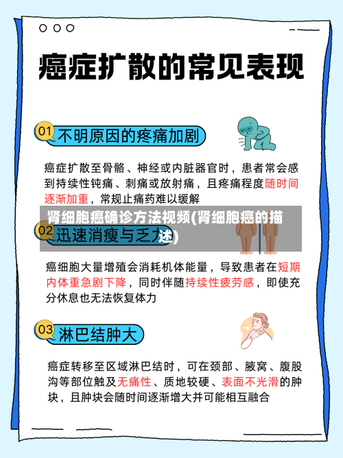肾细胞癌确诊方法视频(肾细胞癌的描述)