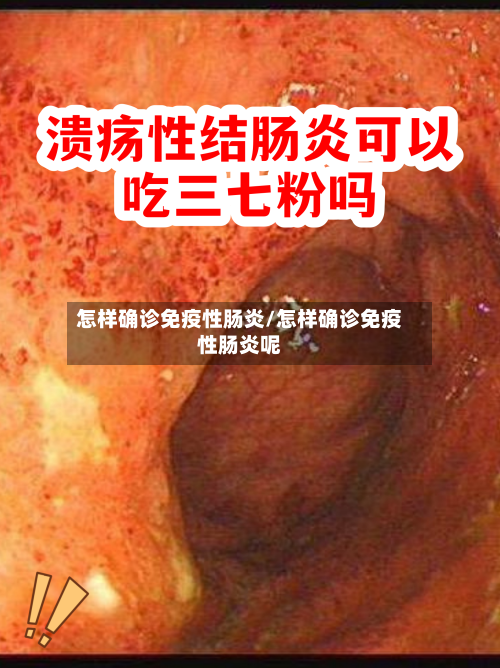 怎样确诊免疫性肠炎/怎样确诊免疫性肠炎呢