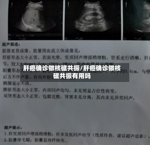 肝癌确诊做核磁共振/肝癌确诊做核磁共振有用吗