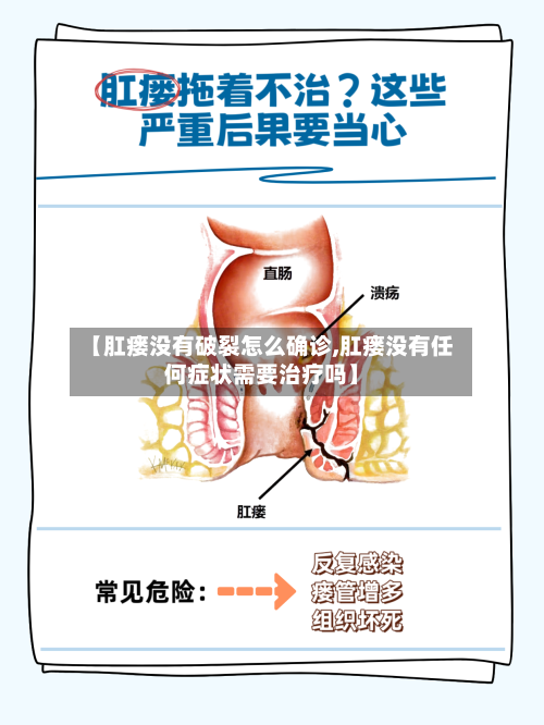 【肛瘘没有破裂怎么确诊,肛瘘没有任何症状需要治疗吗】