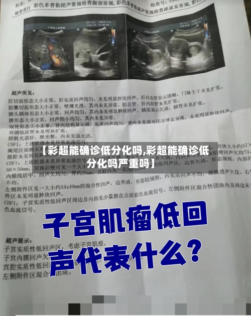 【彩超能确诊低分化吗,彩超能确诊低分化吗严重吗】