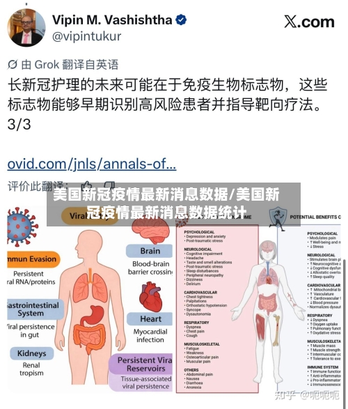 美国新冠疫情最新消息数据/美国新冠疫情最新消息数据统计