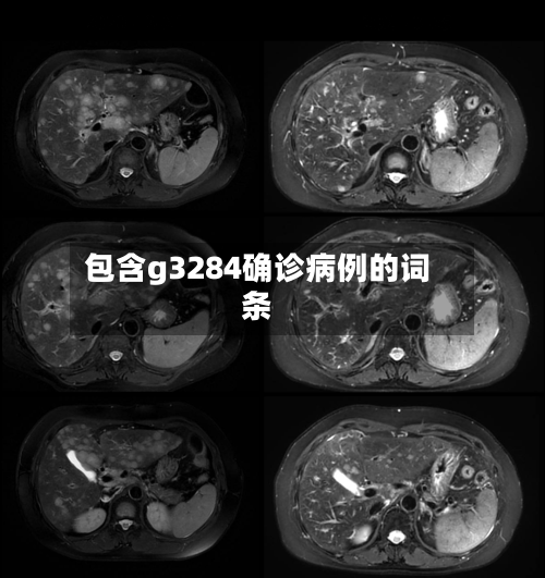包含g3284确诊病例的词条