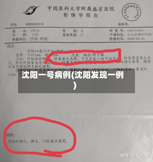 沈阳一号病例(沈阳发现一例)