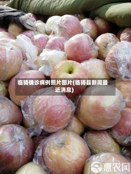 临猗确诊病例照片图片(临猗县新闻最近消息)