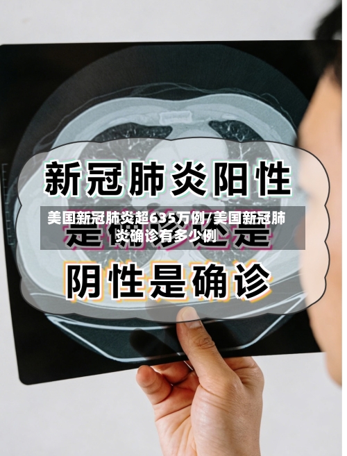 美国新冠肺炎超635万例/美国新冠肺炎确诊有多少例