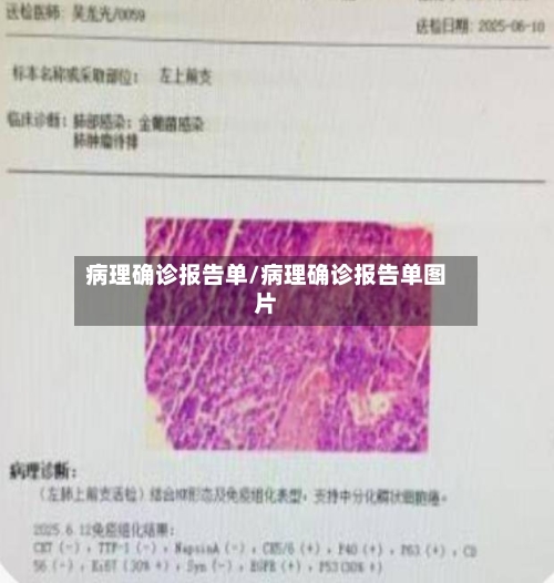 病理确诊报告单/病理确诊报告单图片