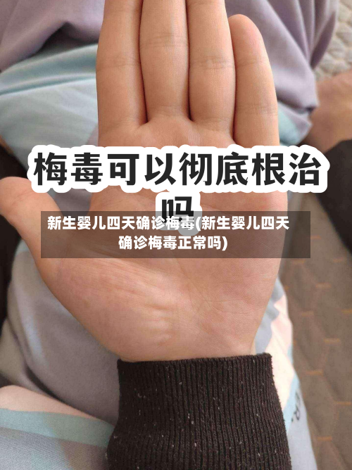 新生婴儿四天确诊梅毒(新生婴儿四天确诊梅毒正常吗)