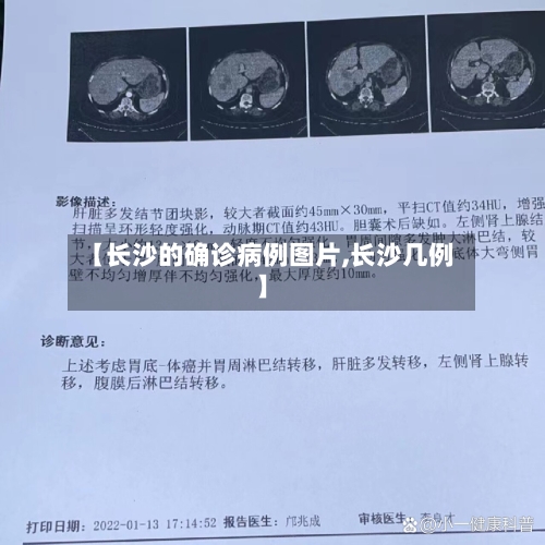 【长沙的确诊病例图片,长沙几例】