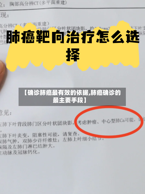 【确诊肺癌最有效的依据,肺癌确诊的最主要手段】
