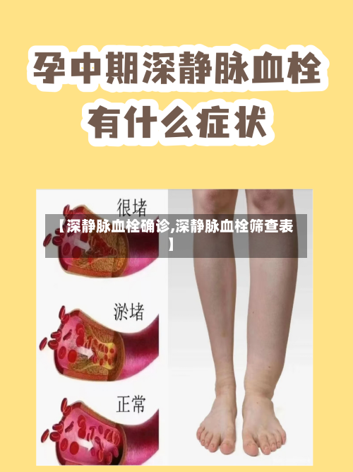 【深静脉血栓确诊,深静脉血栓筛查表】