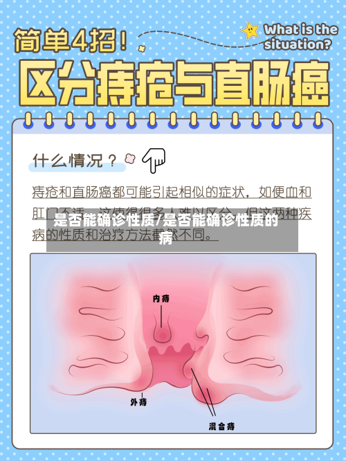 是否能确诊性质/是否能确诊性质的病