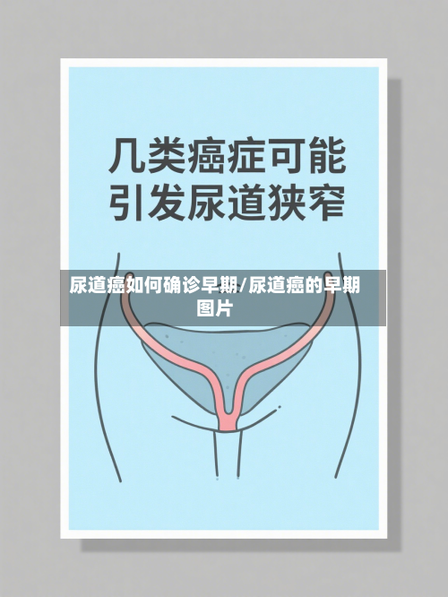 尿道癌如何确诊早期/尿道癌的早期图片