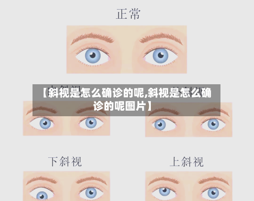 【斜视是怎么确诊的呢,斜视是怎么确诊的呢图片】