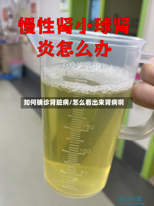 如何确诊肾脏病/怎么看出来肾病啊