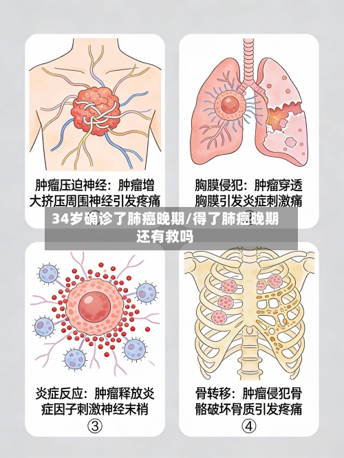 34岁确诊了肺癌晚期/得了肺癌晚期还有救吗
