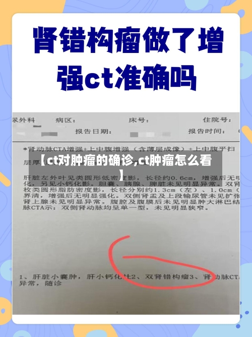 【ct对肿瘤的确诊,ct肿瘤怎么看】