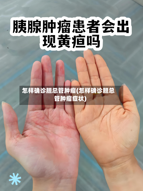 怎样确诊胆总管肿瘤(怎样确诊胆总管肿瘤症状)