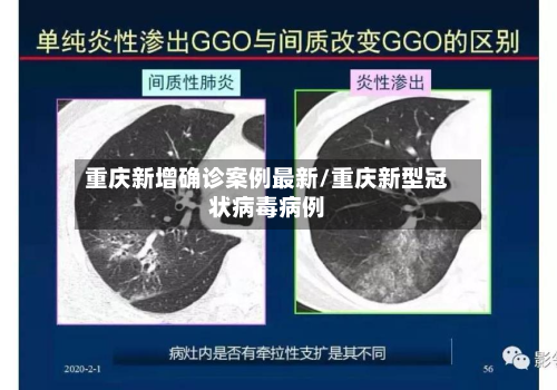 重庆新增确诊案例最新/重庆新型冠状病毒病例