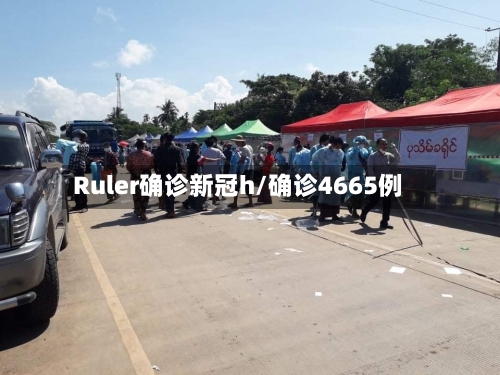 Ruler确诊新冠h/确诊4665例
