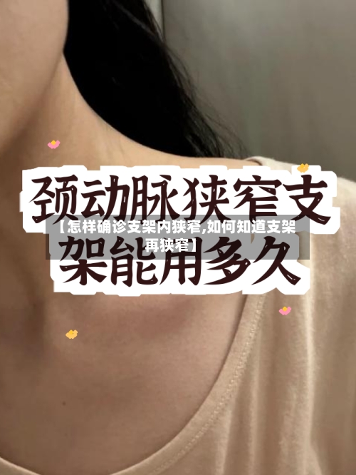 【怎样确诊支架内狭窄,如何知道支架再狭窄】
