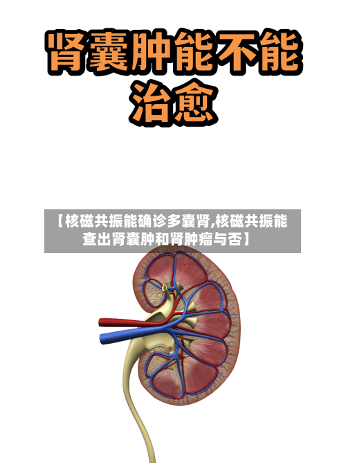【核磁共振能确诊多囊肾,核磁共振能查出肾囊肿和肾肿瘤与否】