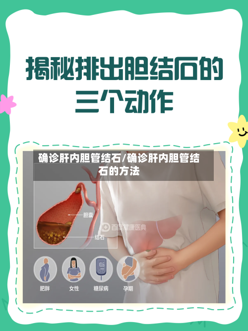 确诊肝内胆管结石/确诊肝内胆管结石的方法